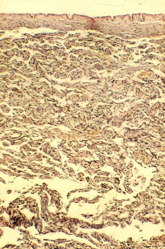 Complete cross section of tamarin placenta, amnion above. Note the trabecular structure
