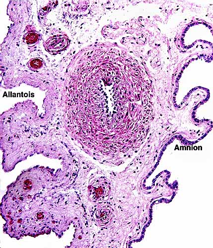 Membranes with degenerated allantoic epithelium and amnion
