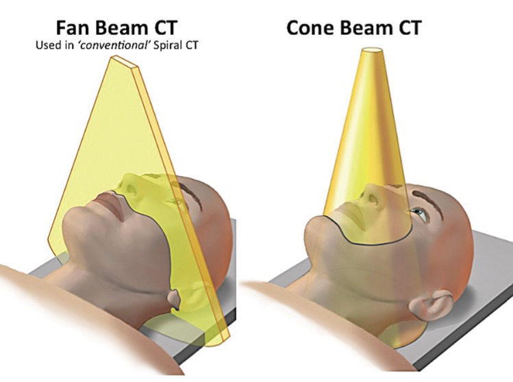 Ilustração de tomografia cone beam