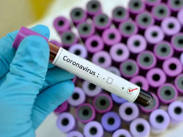 Coronavirus sample