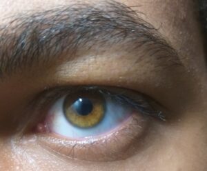 How rare are amber eyes and what makes them unique? - Glasses