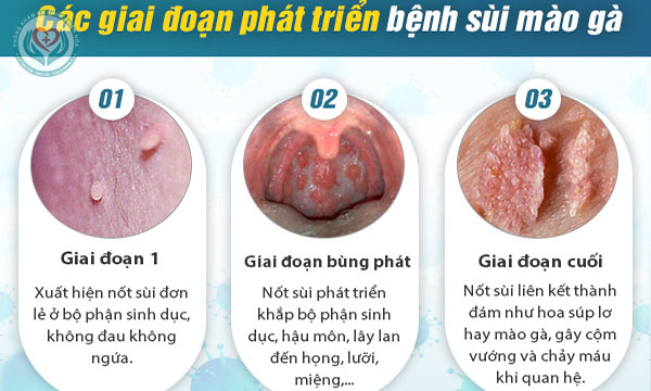 dấu hiệu của bệnh sùi mà gà