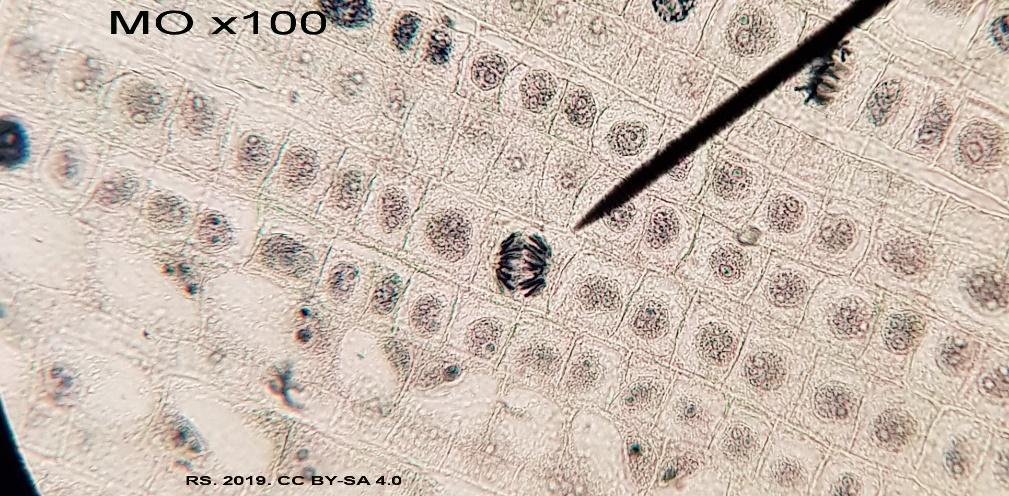 G:\G Photos Sciences\Biologie cellulaire\mitose racine ail 5.jpg