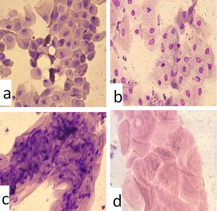 Images of cornified cells in water buffalo (C and D) compared to other epithelial cell stages. A. Parabasal cell dominated smear. B. Intermediate cells dominated smear (early and late stage). C. Late intermediate (already considered cornified with small nucleus) dominated smear. D. Purely cornified cells without nucleus. Artificial insemination of two doses 12 to 18 h apart is successful when performed in both C&D conditions [50].