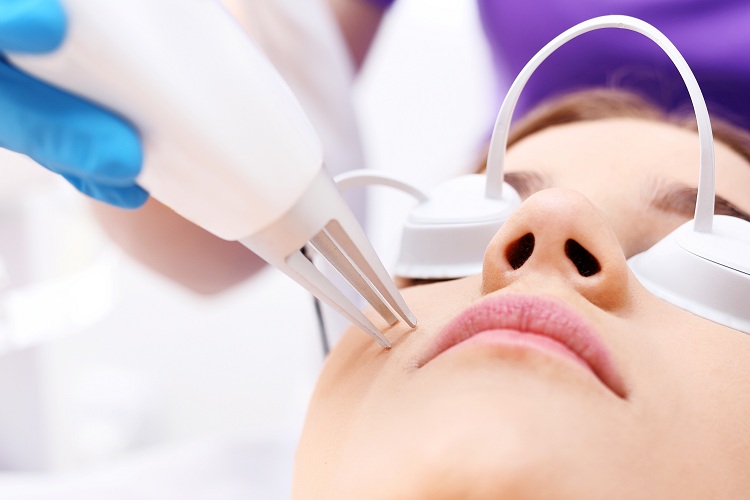 Trị nám chuyên sâu, đánh bay tàn nhang, điều trị sẹo mụn bằng công nghệ Laser CO2 Fractional