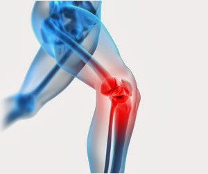 Síndrome de la cintilla iliotibial o rodilla del corredor