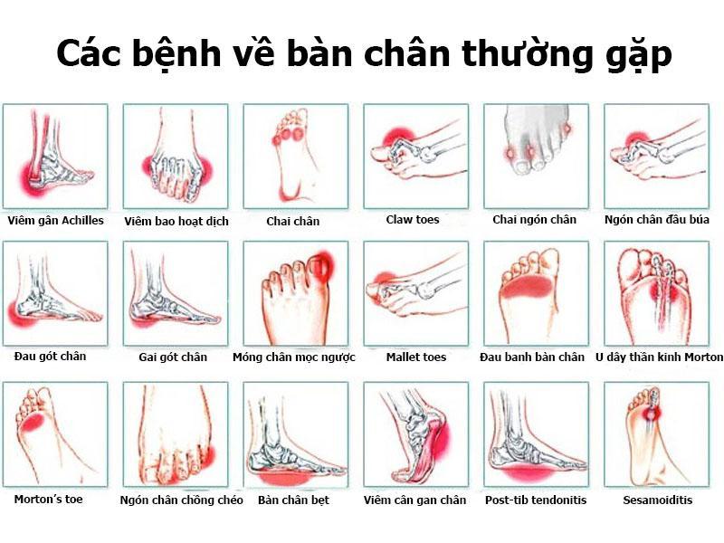 hinh-dau-ban-chan