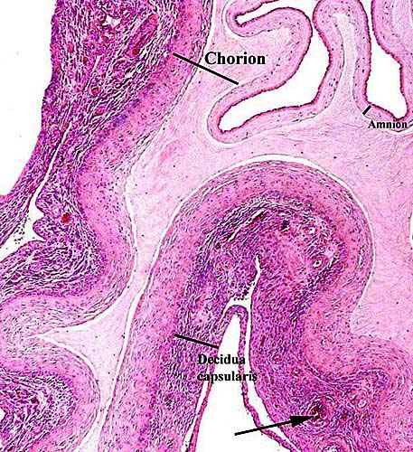 Rolled membranes between placental lobes. At arrow is a maternal, decidual spiral arteriole