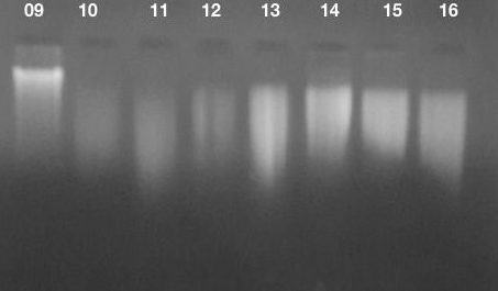 gDNA gel electrophoresis image 5.