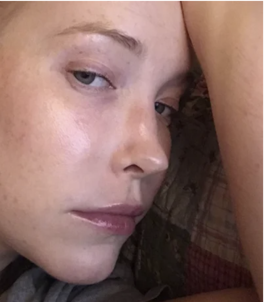 Dallas Rhinoplasty Center review