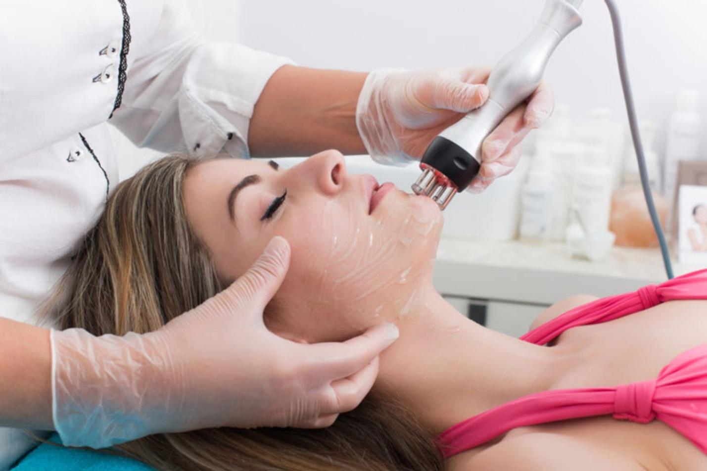 Kết quả hình ảnh cho Trị vết thâm sau mụn bằng laser