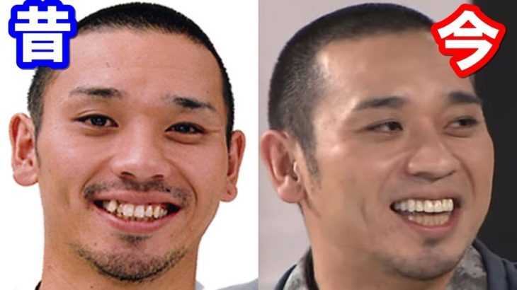 千鳥 大悟さんの歯並びが昔と劇的に変わった キレイになったその理由は