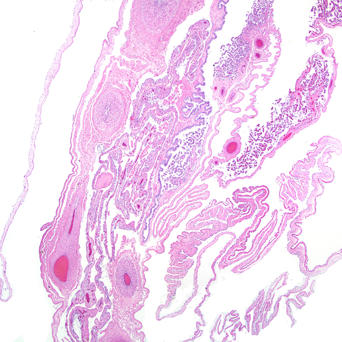 Membranes with amnion at left and large fetal vessels in chorion.