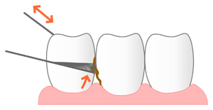 dental_floss_02