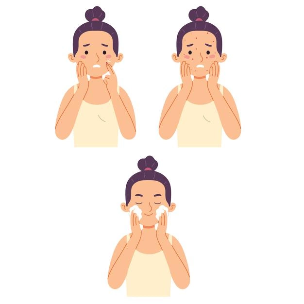 Làm sạch da mặt là bước không thể thiếu trong skincare da bị mụn