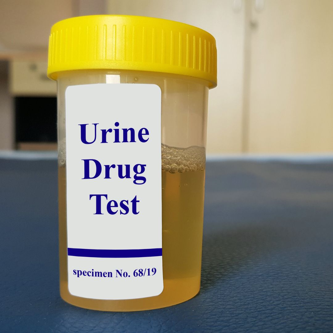 urine drug test cup