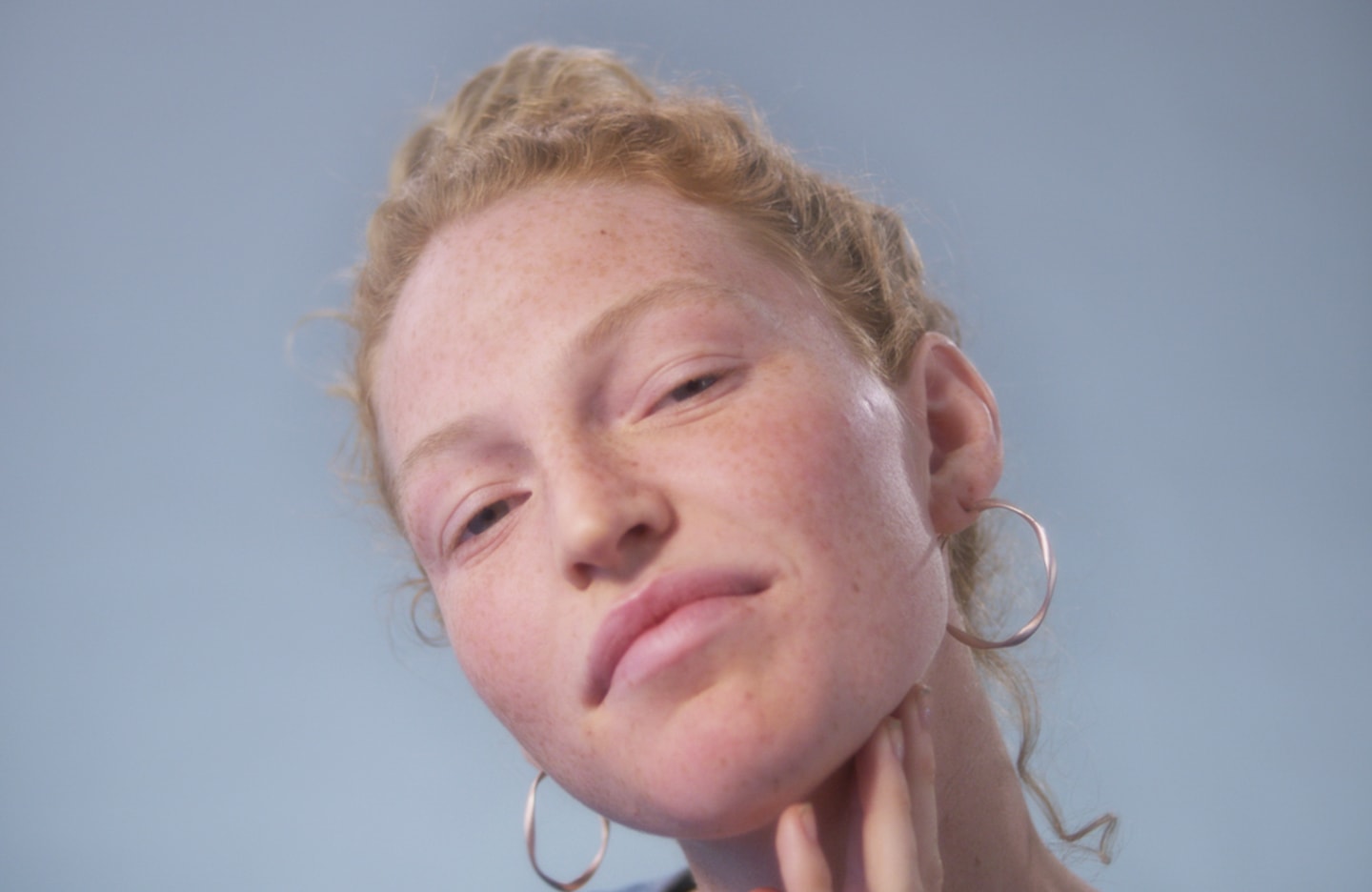 dark spot pimples blog1.jpg
