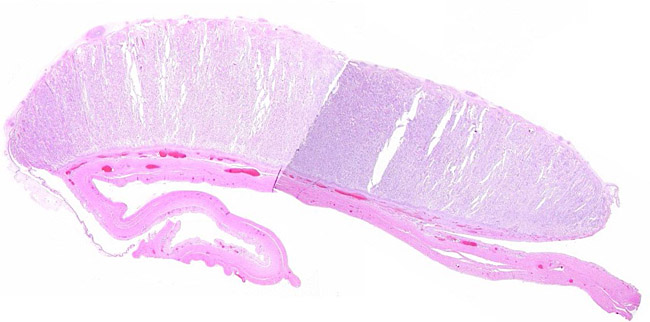 Composite of two sections of large, flat cotyledon