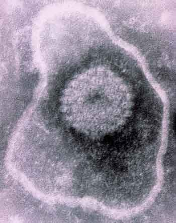 Electron photomicrograph of a negatively stained virion particle of equine herpesvirus type 4 (EHV-4). The central nucleocapsid structure, comprised of 162 hollow capsomeres arranged as an icosahedral shell, encloses the viral DNA. The nucleocapsid is surrounded by a flexible lipid membrane (envelope) containing numerous virus-encoded glycoproteins.