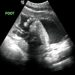 ss_week32_ultrasound.jpg