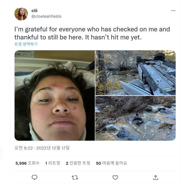 미국 LA에서 현대차 엘란트라N 차량을 운전하다 90미터 절벽으로 추락했으나 큰 중상없이 살아남은 클로에 필즈가  자신을 걱정해준 사람들에게 자신의 얼굴사진과 함께 감사 트윗을 남겼다./클로에 필즈 트위터