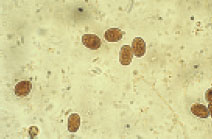 Oocysts from Giardia Oocysts survive in humid environments and some wild animals are reservoirs of this disease