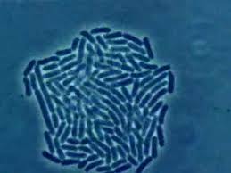 Image result for bacteria growing