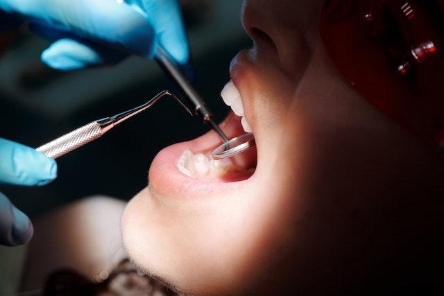 A modern dental alignment treatment