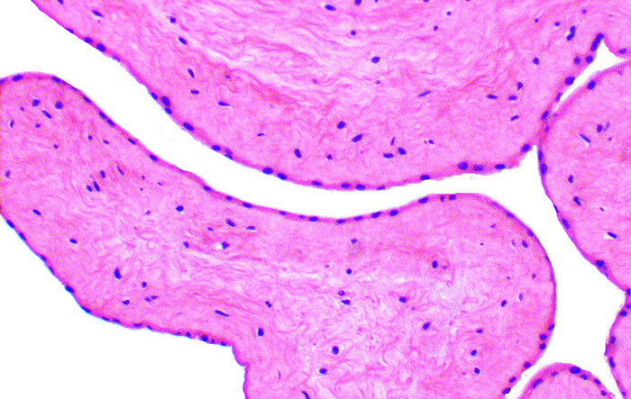 The amnion is single-layered and has very flat epithelium without squamous metaplasia