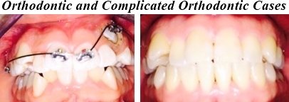 comp ortho case before and after 2.jpg