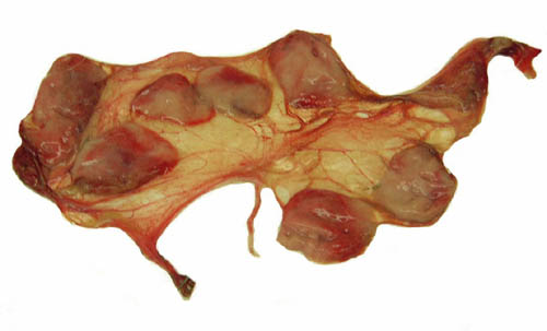 Macroscopic appearance of Royal Antelope placenta with tiny umbilical cord in the center