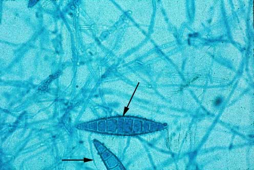 Microsporum canis , se muestra las hifas septadas y numerosas macroconidias fusiformes (flecha) de pared ancha, que contienen más de 6 septos.
