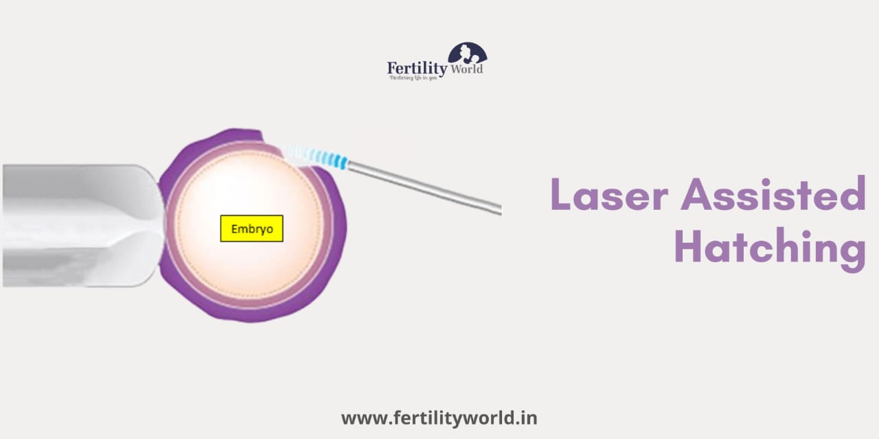 Laser-Assisted Hatching (LAH)