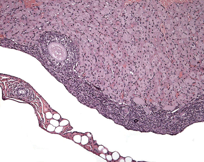 Corpus luteum of pregnancy with adjacent developing follicle; note the bursa.