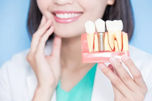 Demystifying Dental Implant Coverage