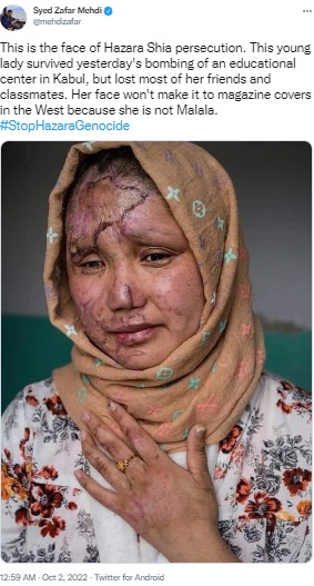 A photo of a woman survivor from a 2016 suicide attack against a TV channel in Kabul is being falsely shared as the picture of a Hazara survivor from the September 30, 2022 bombing at an education centre in the Afghanistan capital.